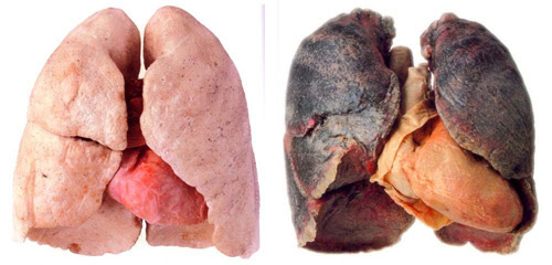 Remove Smoke And Clear Your Lungs By Doing This Simple Recipe! Do This!