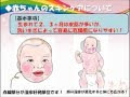 √ 赤ちゃん ワセリン 湿疹 185947