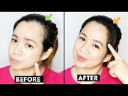 Popullar How To Naturally Grow Back Thinning Hairline Cover up Receding Hairline Beautyklove, Video why are my bangs thinning viral!