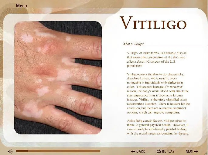 White Skin Spots On Arms