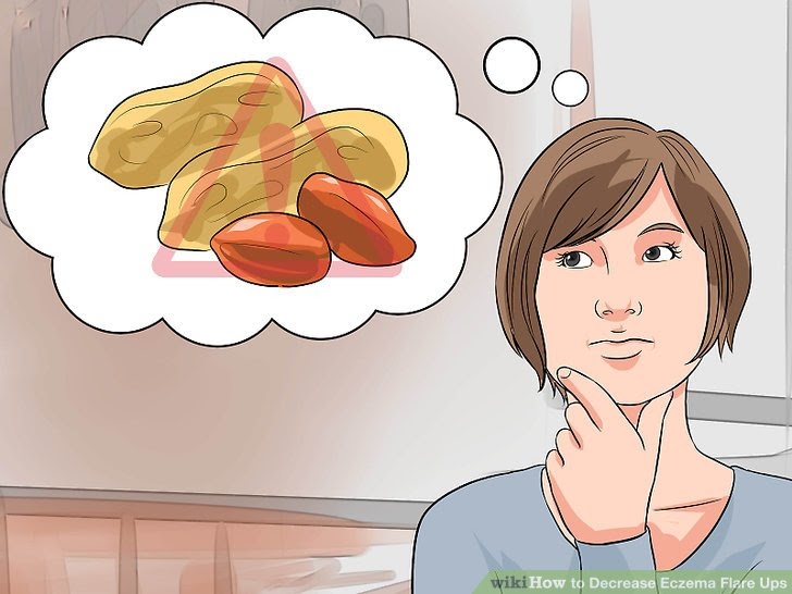 Decrease Eczema Flare Ups Step 5 Version 3.jpg