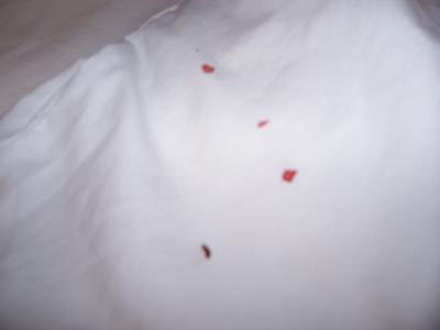 Bed bugs in hotel room. I awoke at 2am to this!