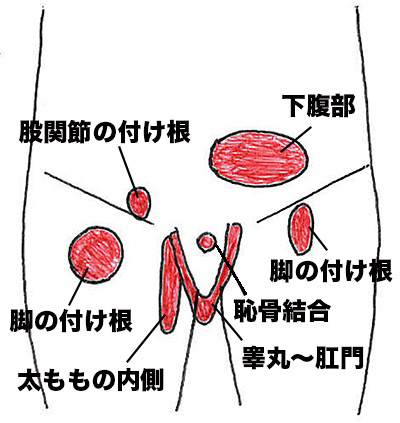 股関節痛 グロインペイン症候群 アスリートゴリラ鍼灸接骨院 旧高林はりきゅう接骨院