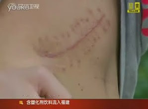 chinese boy sells kidney