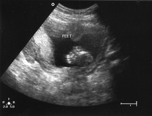 19 Weeks -- FEET!
