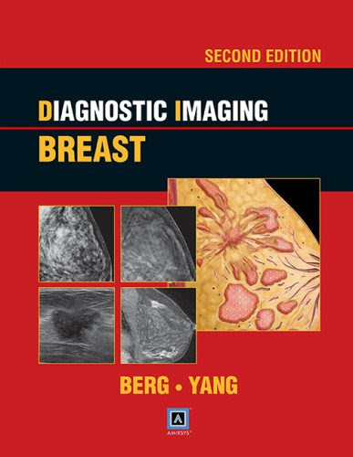 Diagnostic Imaging: Breast, 2nd ed: Published