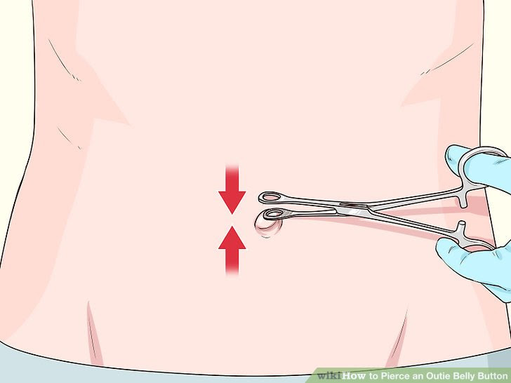 Pierce an Outie Belly Button Step 4.jpg