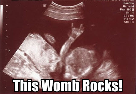 20 Of The Funniest Ultrasound Pictures