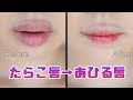 ++ 50 ++ 上唇 薄く する 108931