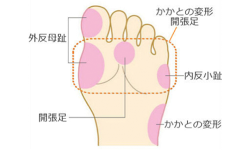 たこ うおのめ すがも小林皮フ科