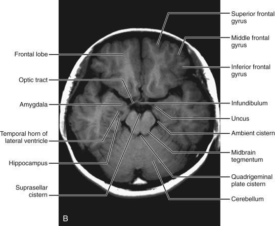 Normal Anatomy | Radiology Key
