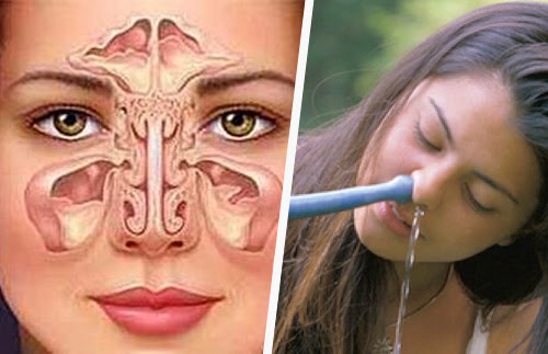 lavar nasal