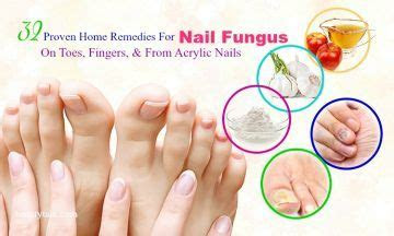 home remedies  nail fungus  toes fingers acrylic