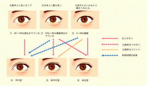 保存版 簡単 二重の幅を自力で広げる方法