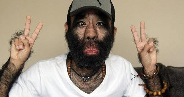 The Monkey Man