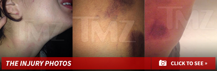 0827-joe-budden-injury-sub-gallery-01
