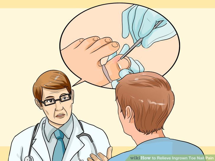 Relieve Ingrown Toe Nail Pain Step 26 Version 2.jpg