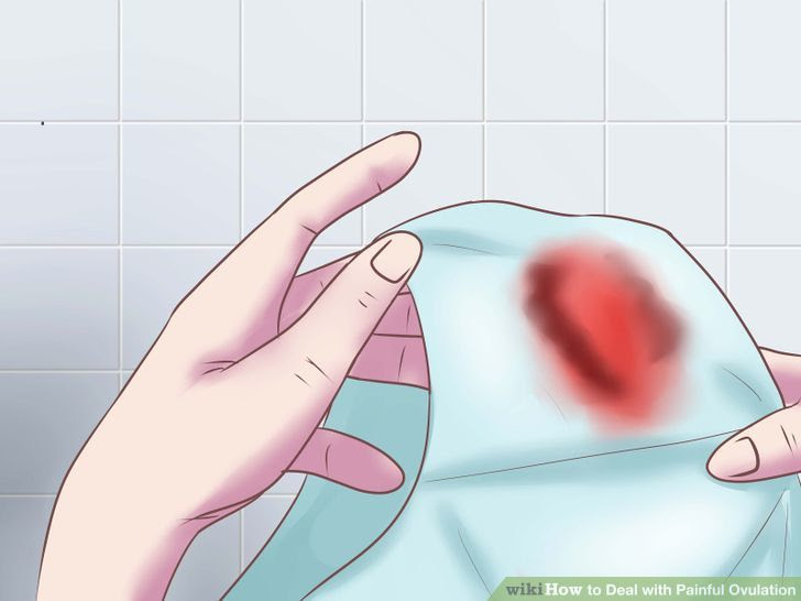 Deal with Painful Ovulation Step 2.jpg