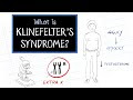 What is Klinefelter's Syndrome?