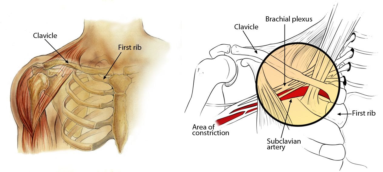 Pain in clavicle shoulder and neck