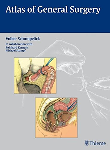 Atlas of General  SurgeryBy Volker Schumpelick