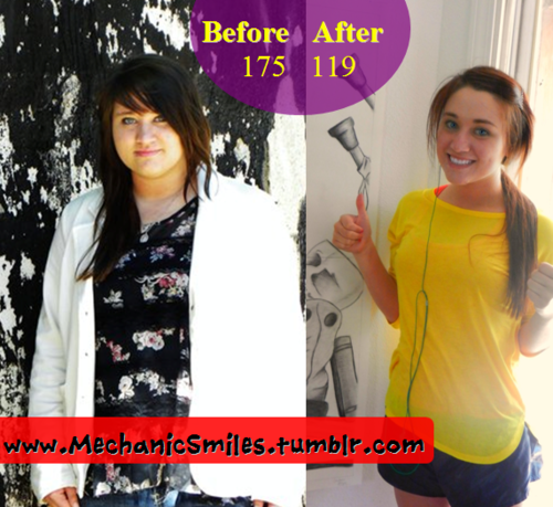 Before and After Weight Loss