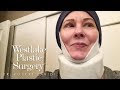 Facelift, Neck Lift And Blepharoplasty Eyelid Surgery Before and After