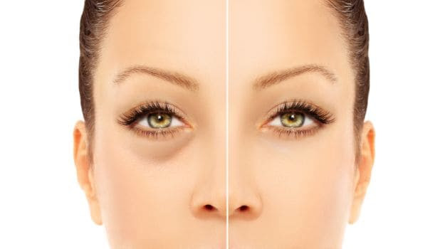  Natural ways to care dark circles