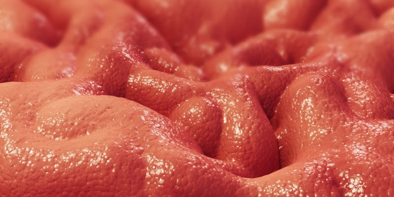 Magenschleimhautentzundung Entzundung Der Magenschleimhaut Gastritis Krankheiten Portal De