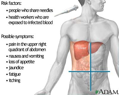 Nursing Assessment for Hepatitis