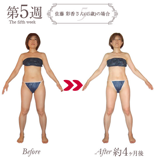 ダイエットモニター募集 大阪 心斎橋のエステ エステサロン スタイルデザイン