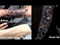 Tattoo Removal Cost London : How Much Will My Laser Tattoo Removal Cost Eraditatt : Removery is here to guide you through your tattoo removal journey.