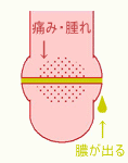 こんなにあるピアストラブル 品川区 あおよこ皮膚科クリニック