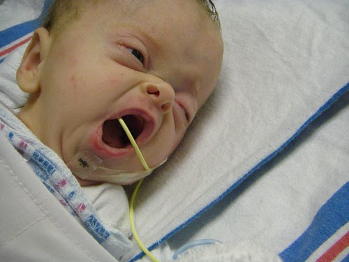 yawn