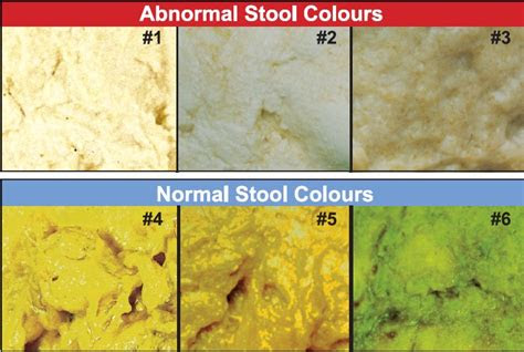  alia ward what does baby poop color mean chart and guide poop