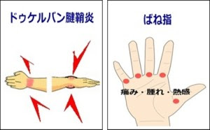 ゴルフ腱鞘炎 その手首や指の治療方法と治し方です ゴルフ通信 松山英樹応援ブログ