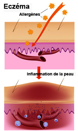 Schema digestion