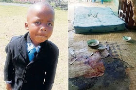 Shocking! See Little Boy Skinned Alive By His Cannibal Uncle Who Drank His Blood And Ate His Heart