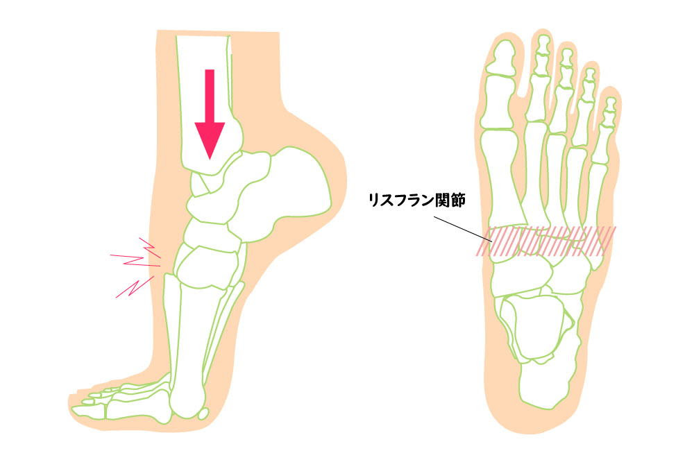 バレエ ダンスに多い怪我とその症状 足首 足部編