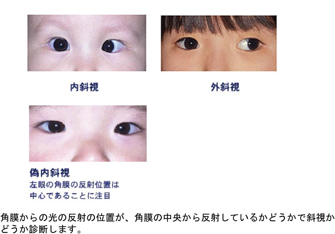 ホーム お知らせ いいだ眼科