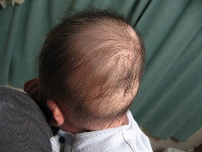 はげ はじめてのお父さん