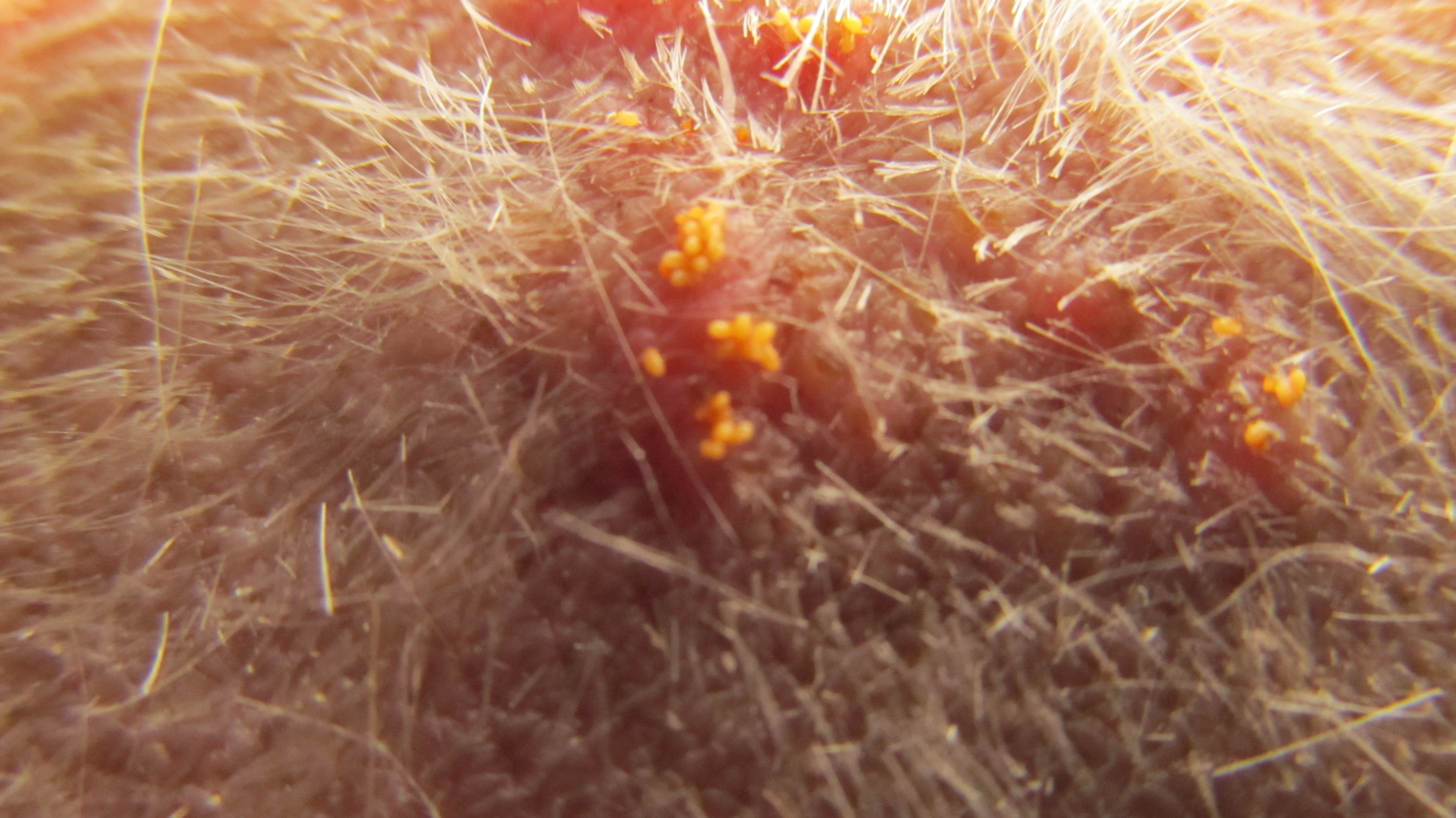 How To Get Rid Of Harvest Mites On Dogs - Garden Design Ideas