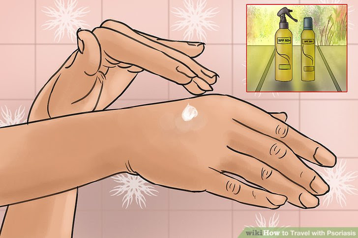 Travel with Psoriasis Step 9.jpg