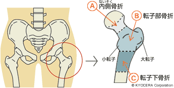 腎臓 濾過 アルブミン