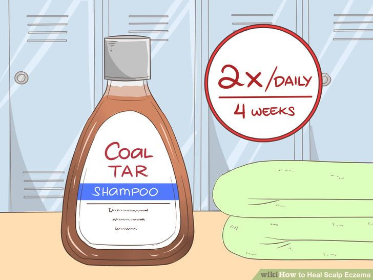 Heal Scalp Eczema Step 16 Version 3.jpg