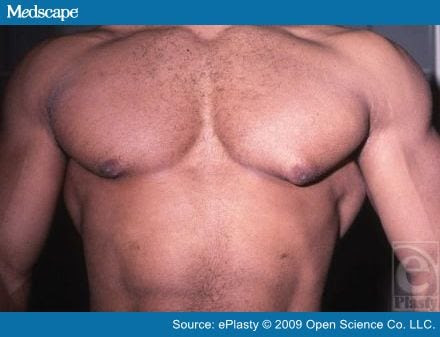Male bitch tits