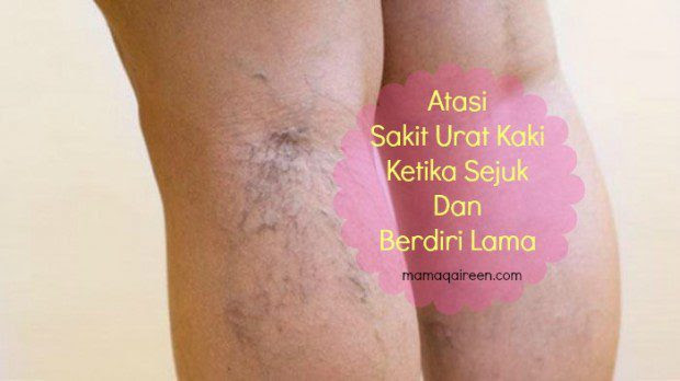Atasi Sakit Urat Kaki Ketika Sejuk Dan Berdiri Lama 