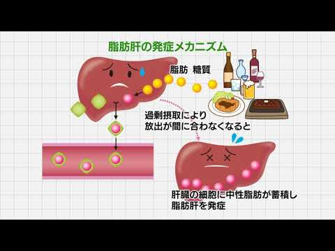 北海道 医pedia 正しく理解しよう 脂肪肝 脂肪肝の原因と症状 国家公務員共済組合連合会 斗南病院