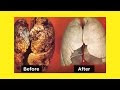 How To Purify Your Lungs In 72 Hours
