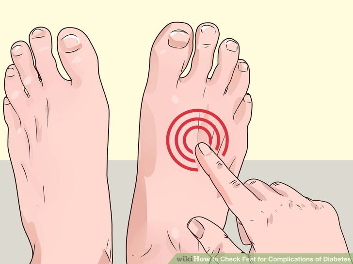 Check Feet for Complications of Diabetes Step 3 Version 2.jpg